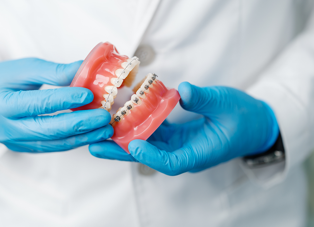 New England orthodontist holding a model of the mouth with braces