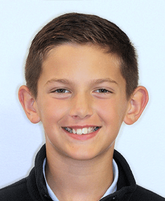 Young boy smiling with misaligned and crowded teeth