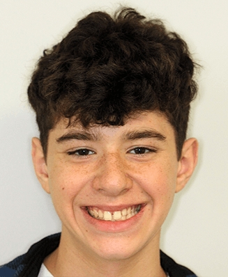 Smiling teenage boy with slightly gapped and crooked teeth