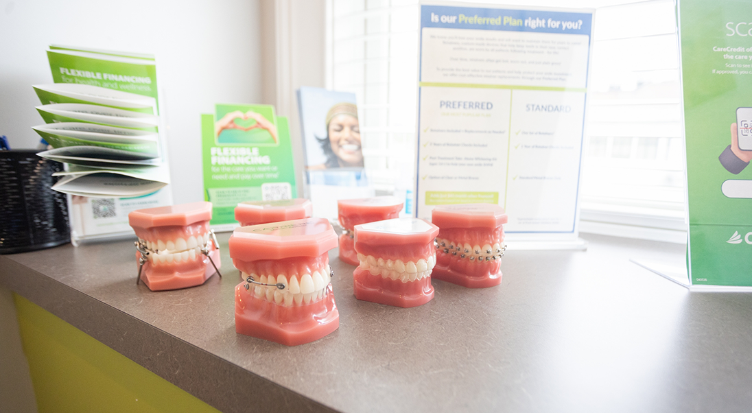 Models of the teeth with and without braces sitting on a desk
