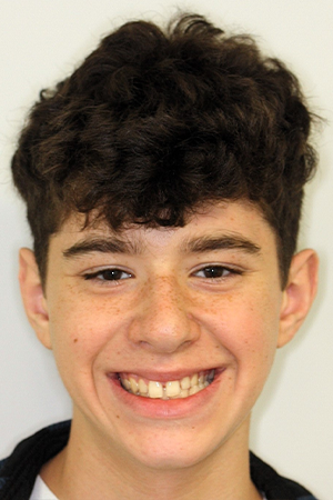 Smiling teenage boy with slightly gapped teeth