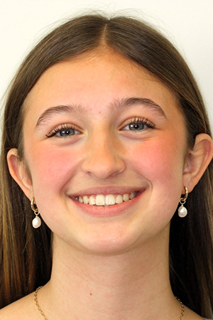 Teenage girl smiling with straightened teeth