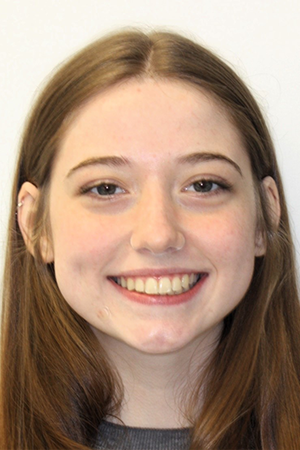 Smiling young woman with straighter teeth