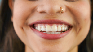 an Invisalign patient smiling confidently