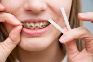 a person holding orthodontic wax