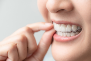 a patient holding their Invisalign aligner