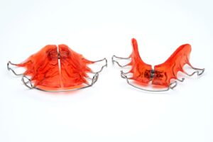 Two types of palatal expanders